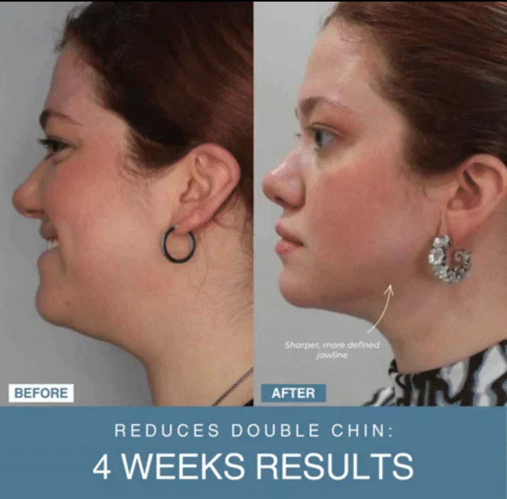 Tijarat™  7-in-1 LED Anti-Aging/Wrinkle Apparatus